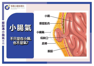 小腸氣不只是在小腸，也不是氣?